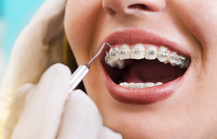 Ortodonzia - Turismo Dentale Aponia Dental & Aesthetic Center
